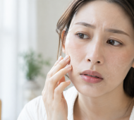 Kem chống nắng cho da khô có cần dưỡng ẩm trước không?